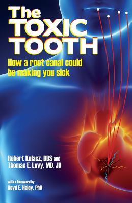 The Toxic Tooth: How a root canal could be making you sick