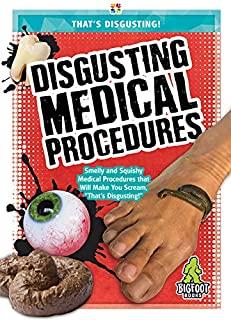 Disgusting Medical Procedures