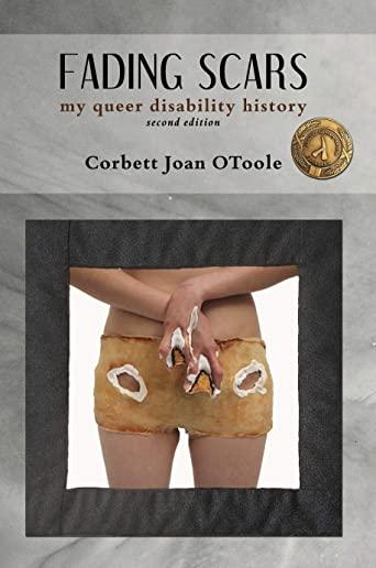 Fading Scars: My Queer Disability History, 2nd Edition